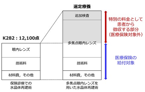 選定療養白内障手術の費用